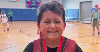 طفل أمريكي يتعرض لحروق في الوجه بسبب ترند NeeDoh على تيك توك