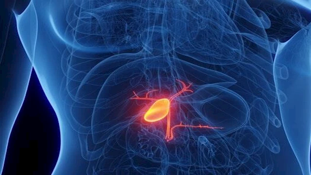 علامات تحذيرية تدل على التهاب المرارة