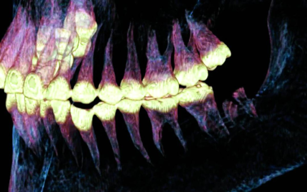 إجراء تاريخي لجراحة الفك