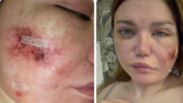 تورّم مفاجئ يؤدي إلى جراحة طارئة لإعلامية شهيرة في ثالث أيام رمضان