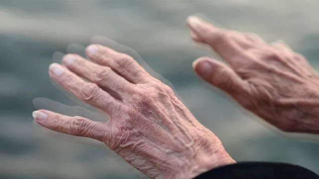 هل يمكن اكتشاف باركنسون من الشعر؟