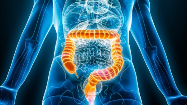 بعد وفاة نجم شهير.. لماذا يزداد سرطان القولون بين الشباب؟