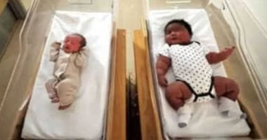 سيدة من نيويورك تلد مولوداً وزنه 5.9 كغ: ما هو تضخم الجنين؟