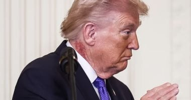 احمرار وتقشير في جلد عنق ترامب.. أطباء يكشفون سبب الطفح الجلدي المؤلم