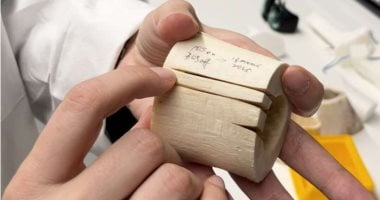 استخدام الليزر في جراحة العظام يحسن النتائج: دراسة تكشف