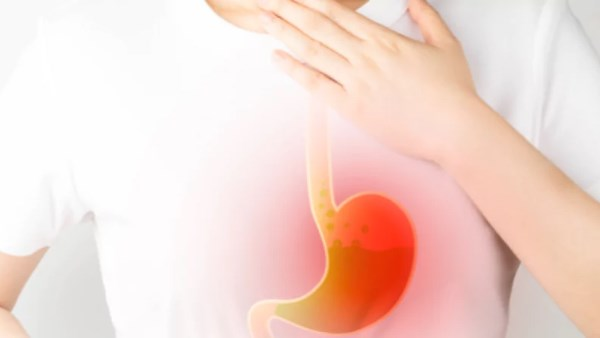 علاج الحموضة: خطوات بسيطة تحمي معدتك في رمضان والعيد