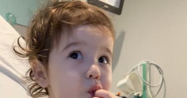 باحثون ينجحون في إنتاج مريء في المختبر للأطفال بعيب خلقي نادر