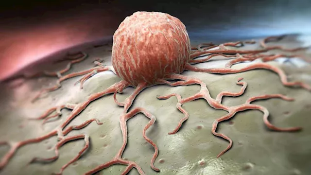 احذر أعراض سرطان قد تكون خطيرة