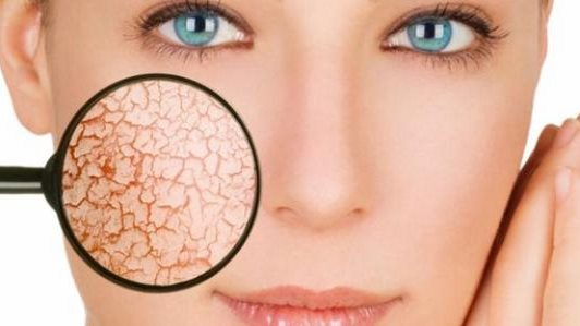 وصفات منزلية طبيعية لعلاج جفاف البشرة