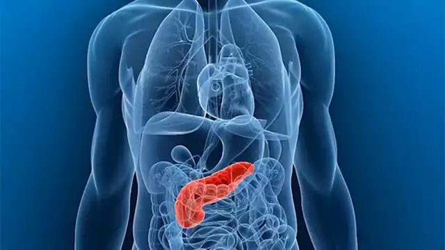 أعراض تظهر قبل تشخيص سرطان البنكرياس